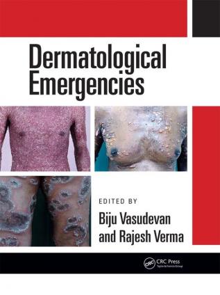 Dermatological Emergencies