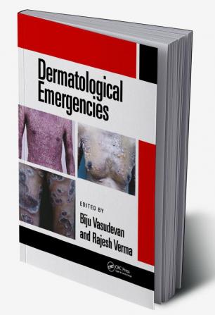 Dermatological Emergencies