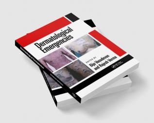 Dermatological Emergencies