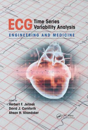 ECG Time Series Variability Analysis