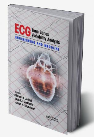 ECG Time Series Variability Analysis