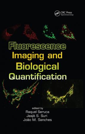 Fluorescence Imaging and Biological Quantification