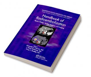 Handbook of Radioembolization