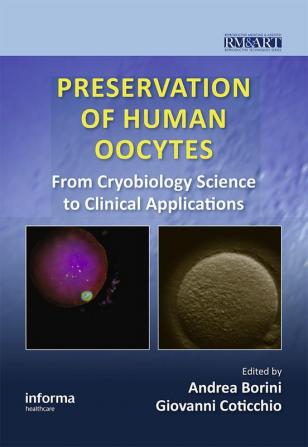 Preservation of Human Oocytes