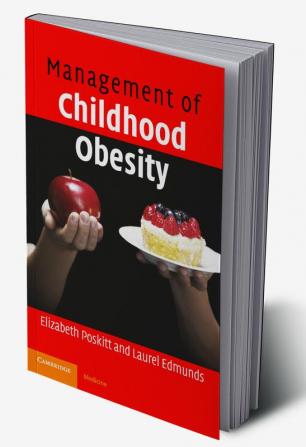 Management of Childhood Obesity