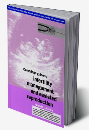 CAMBRIDGE GUIDE TO INFERTILITY MANAGEMENT AND ASSISTED REPRODUCTION (SOUTH ASIA EDITION)