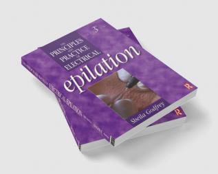 Principles and Practice of Electrical Epilation