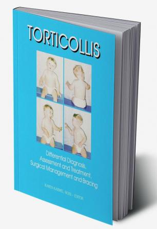 Torticollis