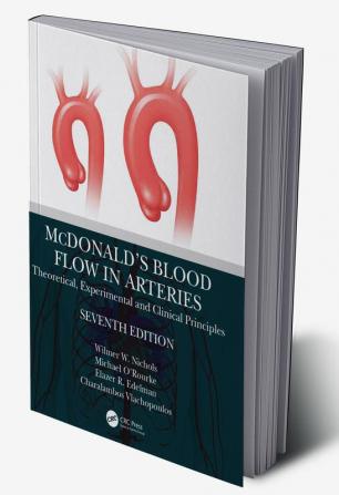 McDonald’s Blood Flow in Arteries