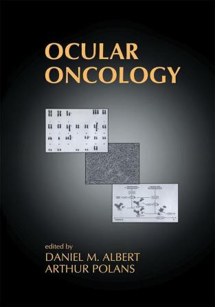 Ocular Oncology