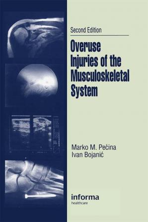 Overuse Injuries of the Musculoskeletal System