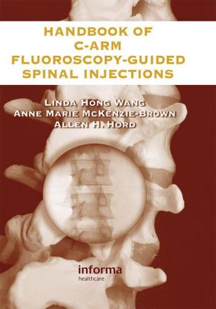 Handbook of C-Arm Fluoroscopy-Guided Spinal Injections