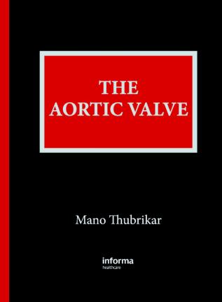 Aortic Valve