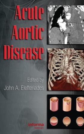 Acute Aortic Disease