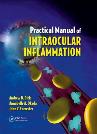 Practical Manual of Intraocular Inflammation