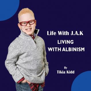 Life With J.A.K Living with Albinism: Living with Albinism