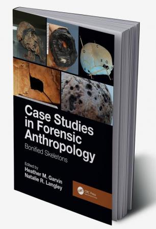 Case Studies in Forensic Anthropology