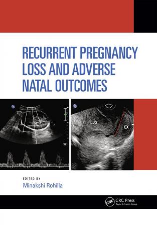 Recurrent Pregnancy Loss and Adverse Natal Outcomes