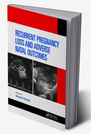 Recurrent Pregnancy Loss and Adverse Natal Outcomes