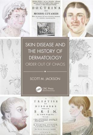 Skin Disease and the History of Dermatology