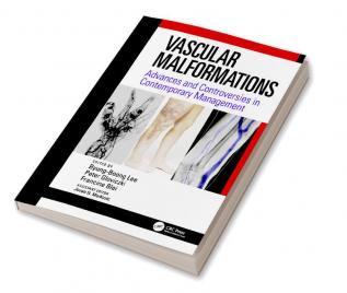 Vascular Malformations