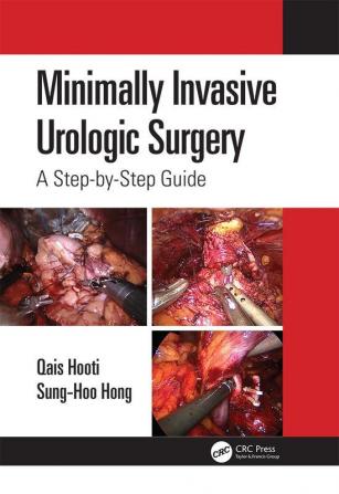 Minimally Invasive Urologic Surgery