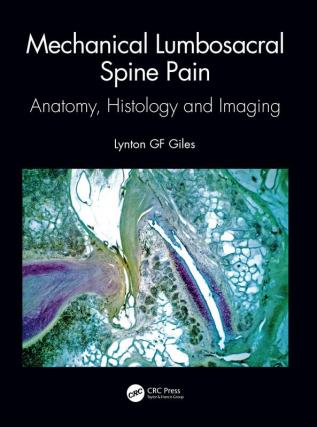 Mechanical Lumbosacral Spine Pain