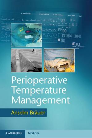 Perioperative Temperature Management