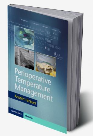 Perioperative Temperature Management