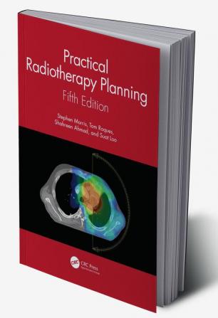 Practical Radiotherapy Planning