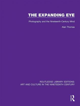 Expanding Eye