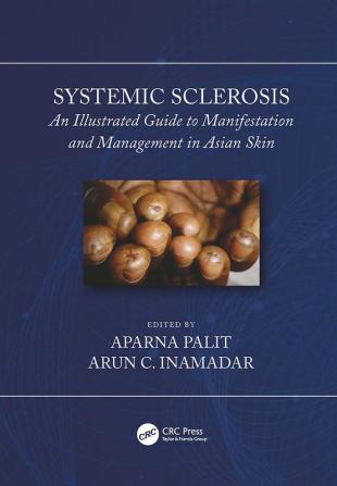 Systemic Sclerosis