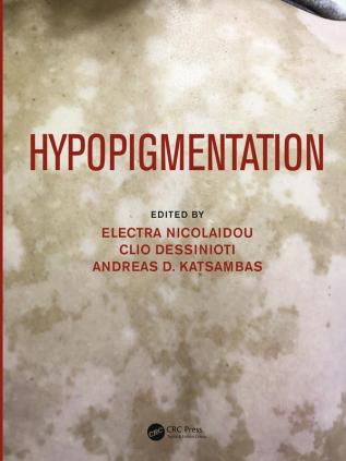 Hypopigmentation