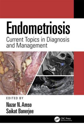 Endometriosis