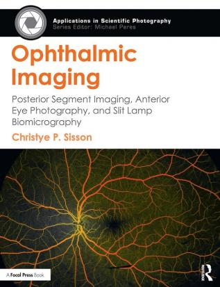 Ophthalmic Imaging