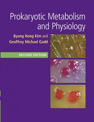 Prokaryotic Metabolism and Physiology