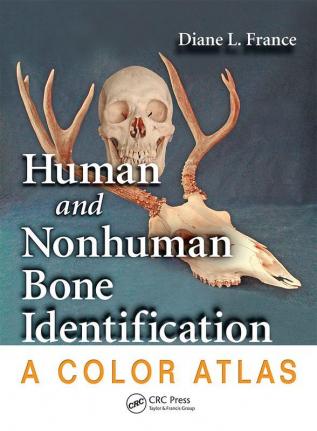 Human and Nonhuman Bone Identification