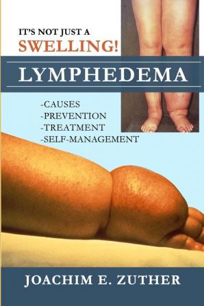 It's Not Just a Swelling! Lymphedema: Causes Prevention Treatment Self-Management