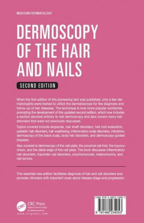 Dermoscopy of the Hair and Nails