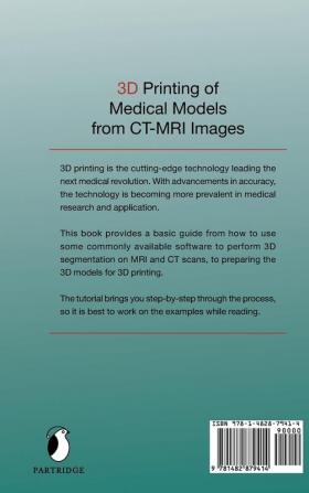 3D Printing of Medical Models from CT-MRI Images