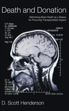 Death and Donation: Rethinking Brain Death as a Means for Procuring Transplantable Organs