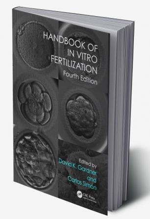 Handbook of In Vitro Fertilization