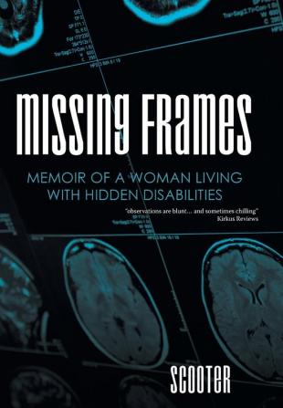 Missing Frames