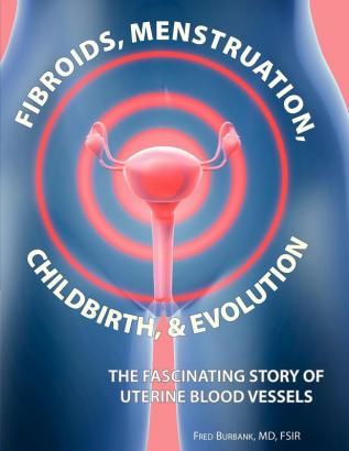 Fibroids Menstruation Childbirth and Evolution: The Fascinating Story of Uterine Blood Vessels