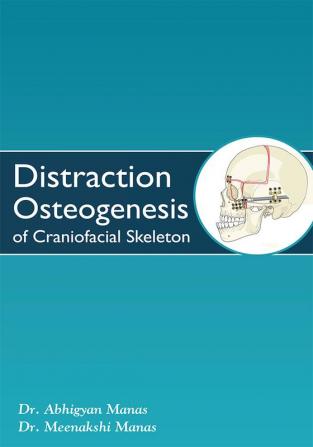 Distraction Osteogenesis of Craniofacial Skeleton