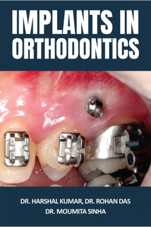 Implants in Orthodontics