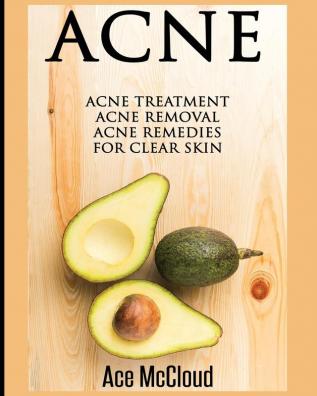 Acne: Acne Treatment: Acne Removal: Acne Remedies For Clear Skin (Acne Skin Care Treatments from Diet & Medical)