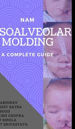 NASOALVEOLAR MOLDING- A COMPLETE GUIDE