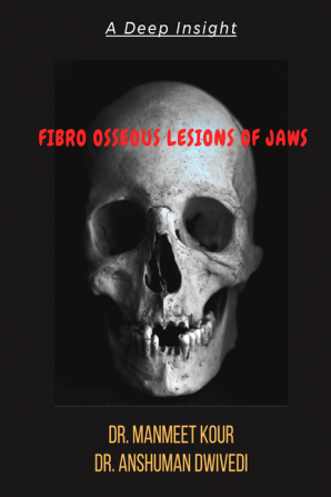 Fibro Osseous Lesions Of Jaws : A deep Insight