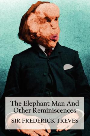 The Elephant Man And Other Reminiscences